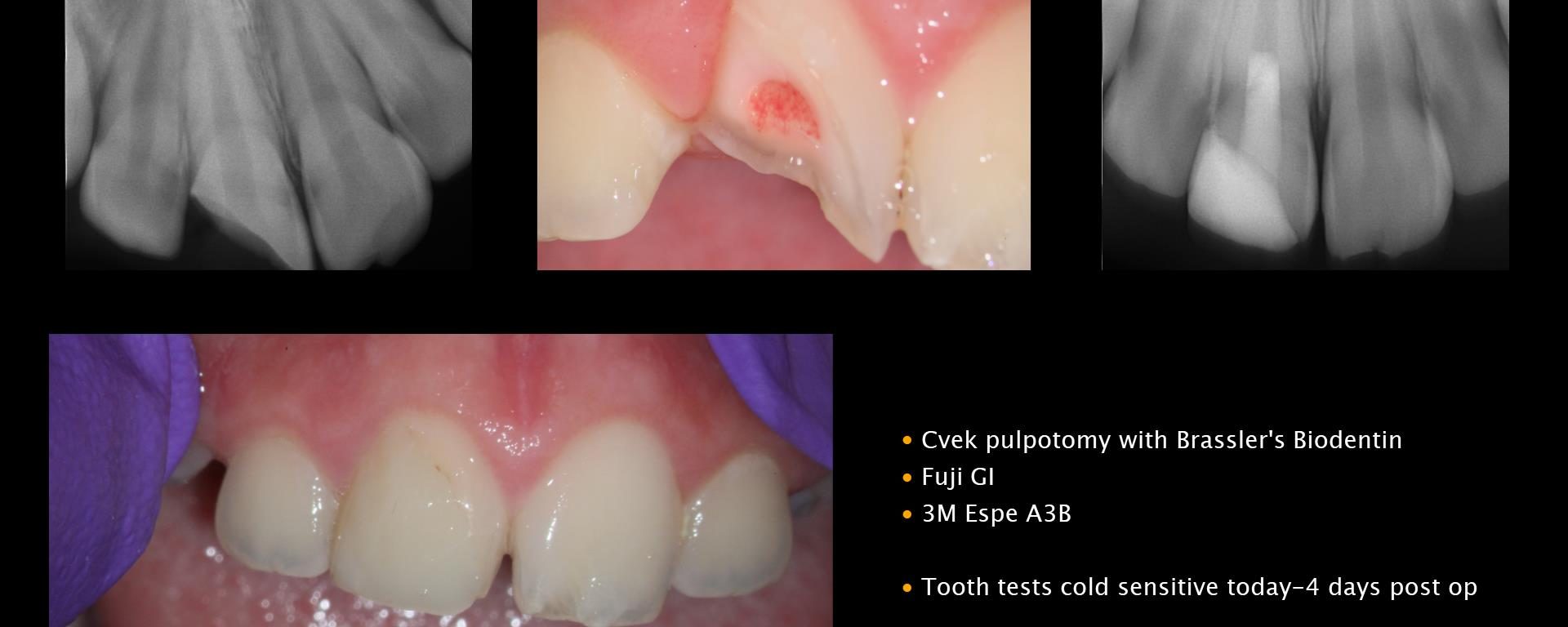 My first trauma in years