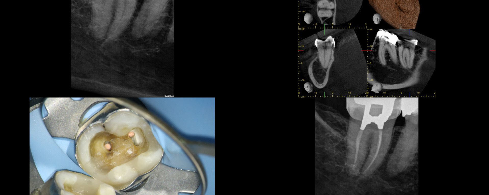 Dual entry of the day