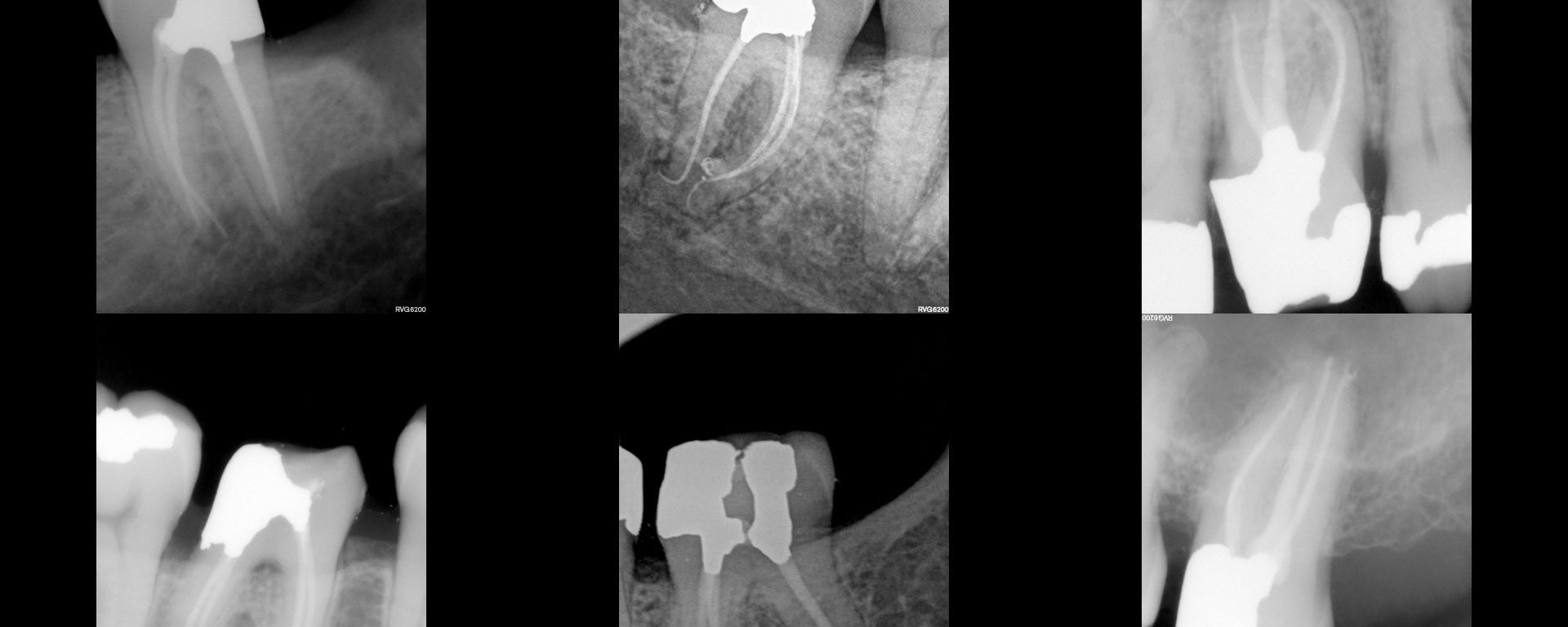 Struggling with elevated margins