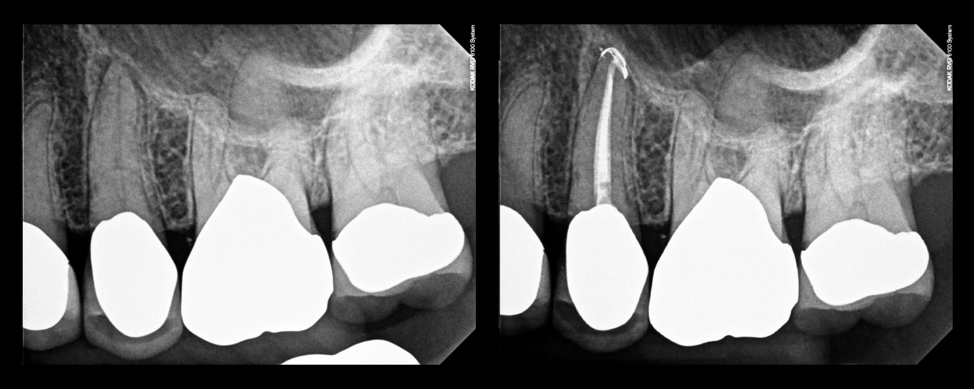 First TDO Outcomes Failure