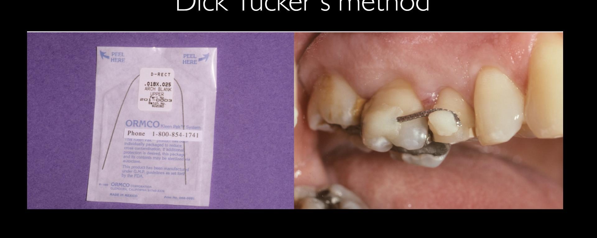 Dick Tucker’s method