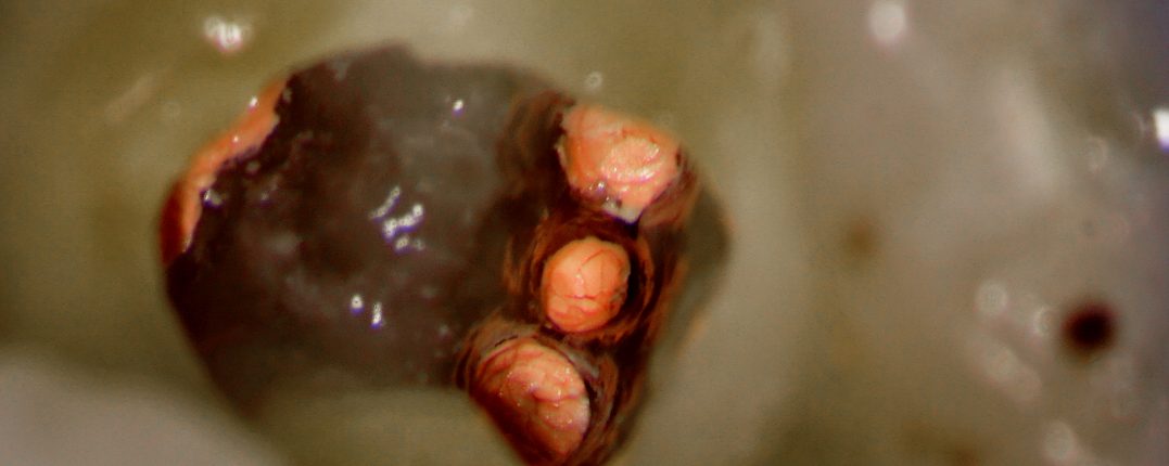 #30 – Soffit Access Preparation