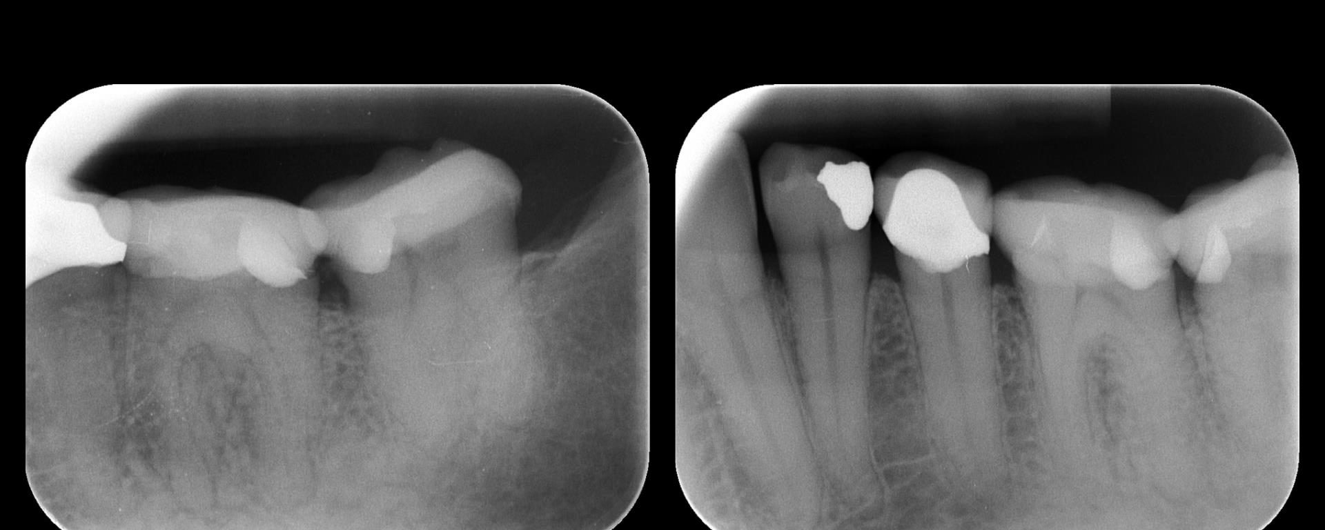 Disappointing recall