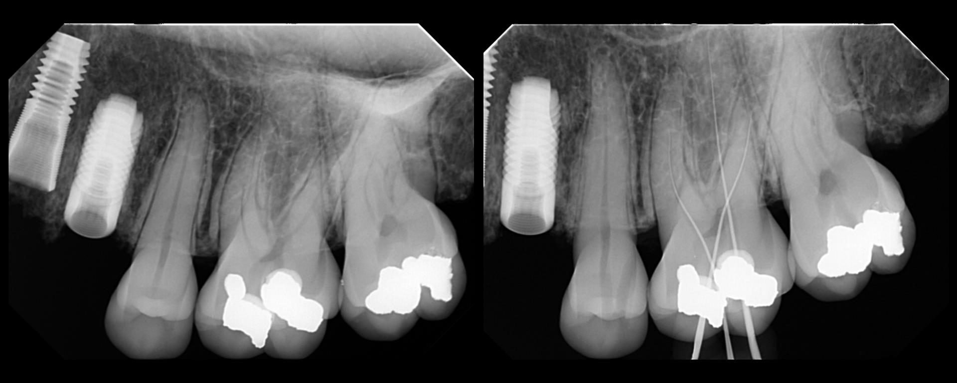 Using TDO Collage and X-Nav