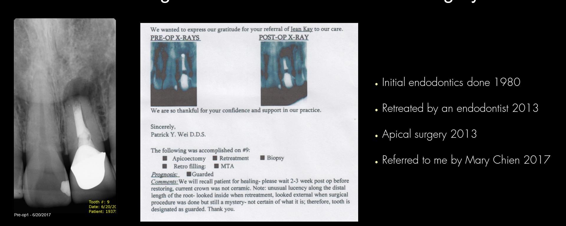 6 mo recall on a retreatment/re-surgery