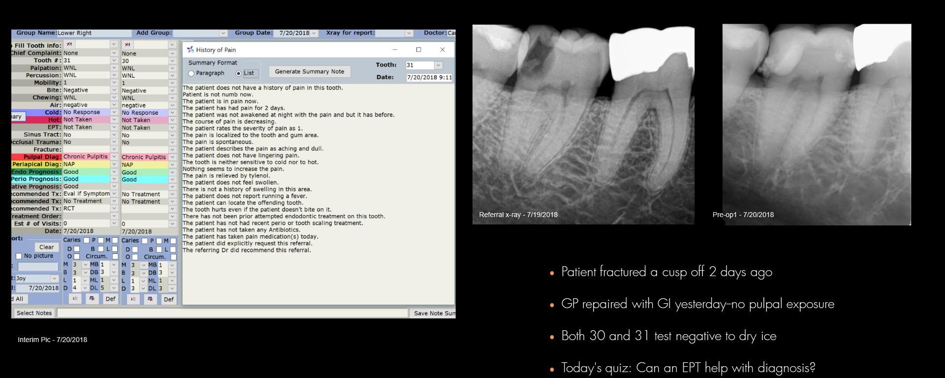 For those who think an EPT helps
