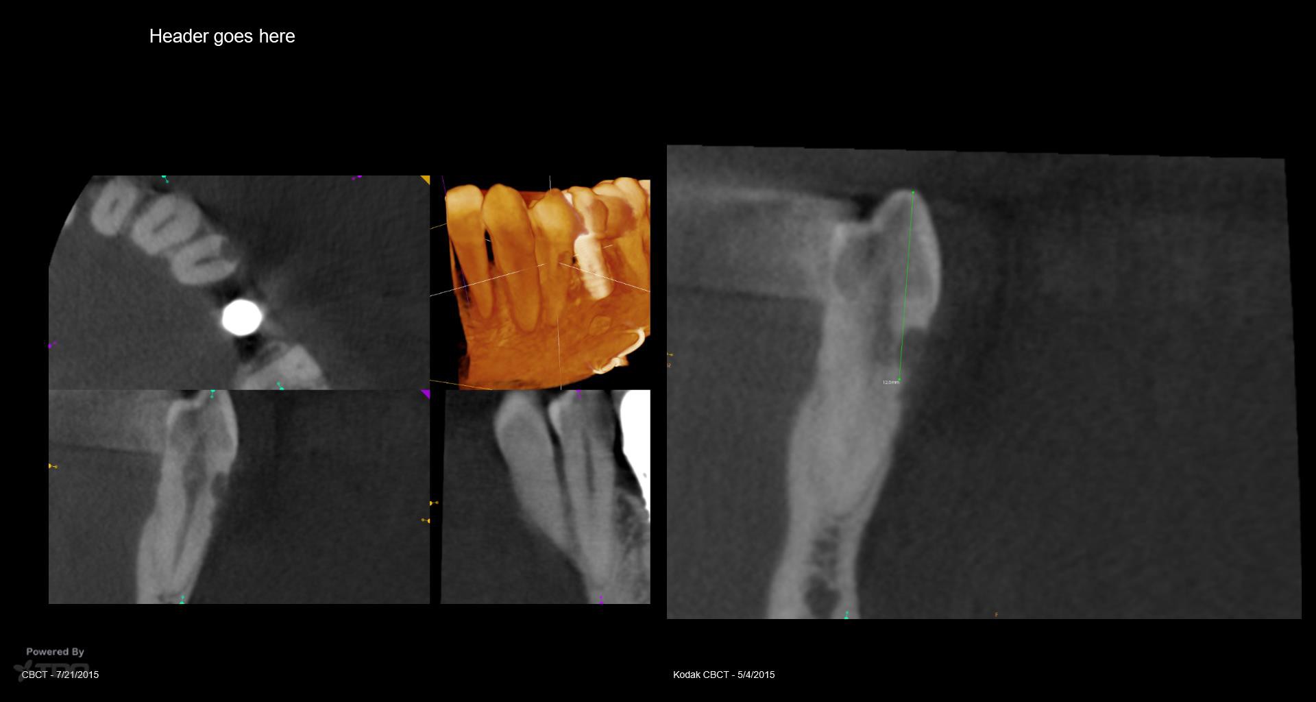 Collage-2140635143-Page00