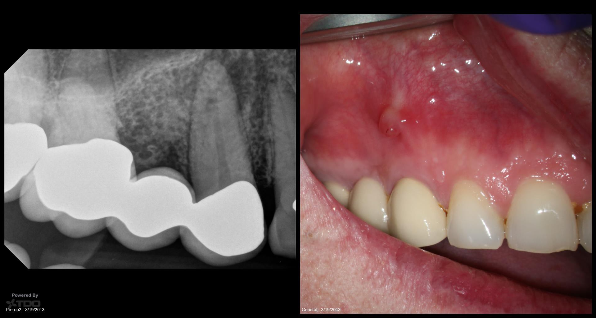 Collage-2140635222-Page00