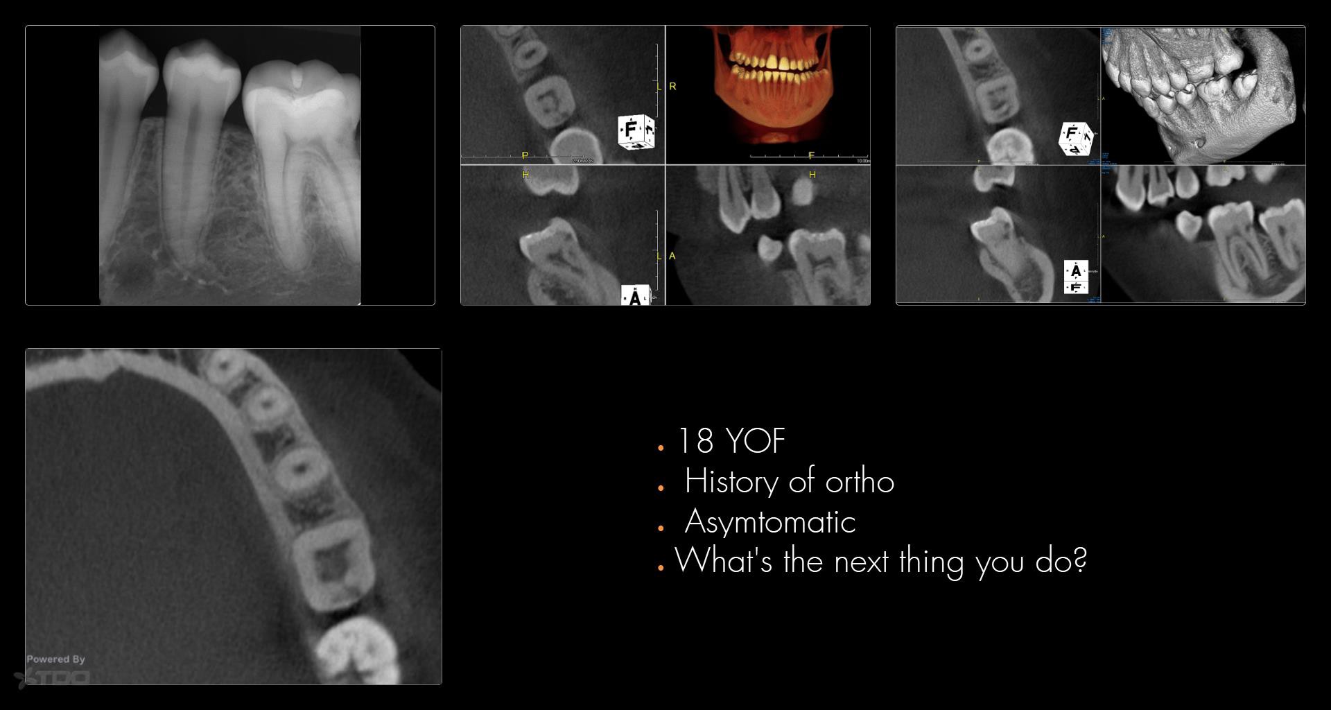 Collage-2140635280-Page00