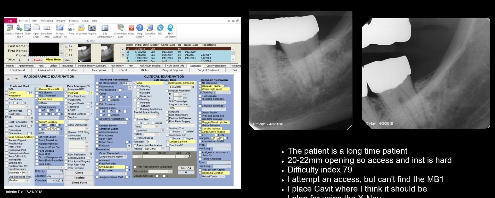 Thought of the X-Nav but didn’t need it