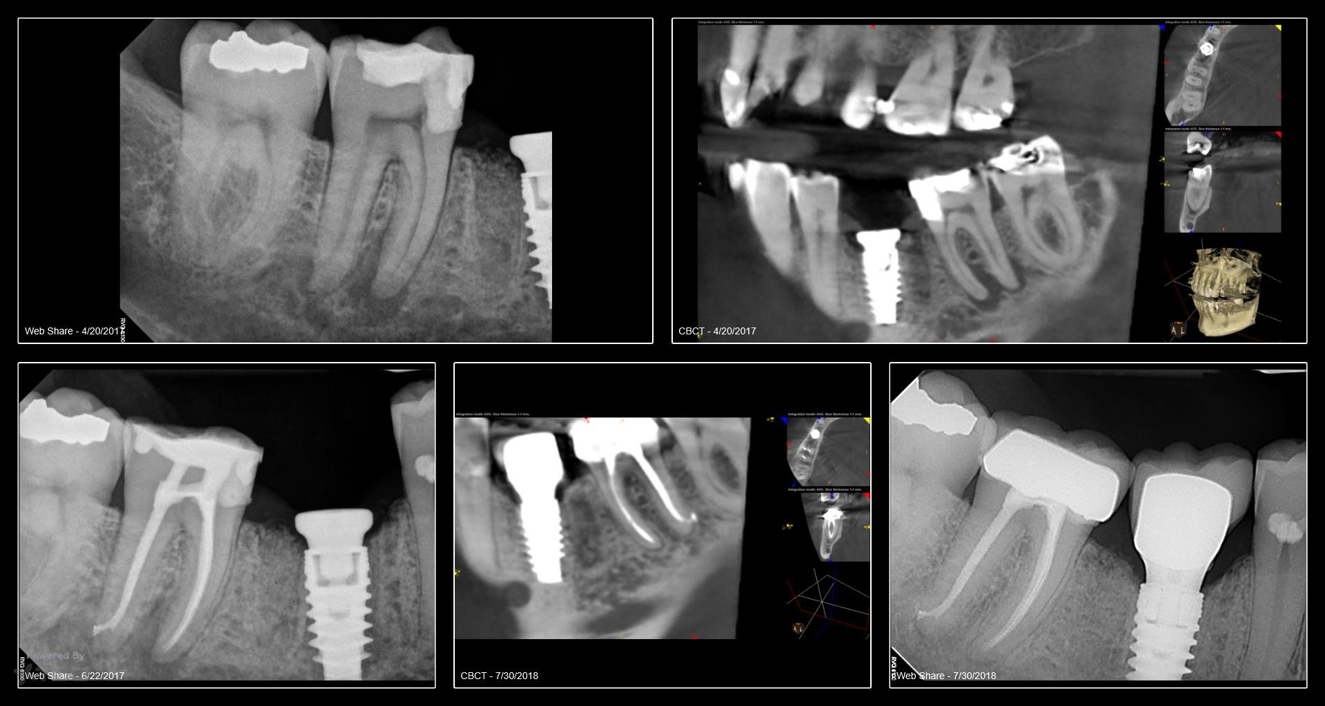Collage-232042-Page00
