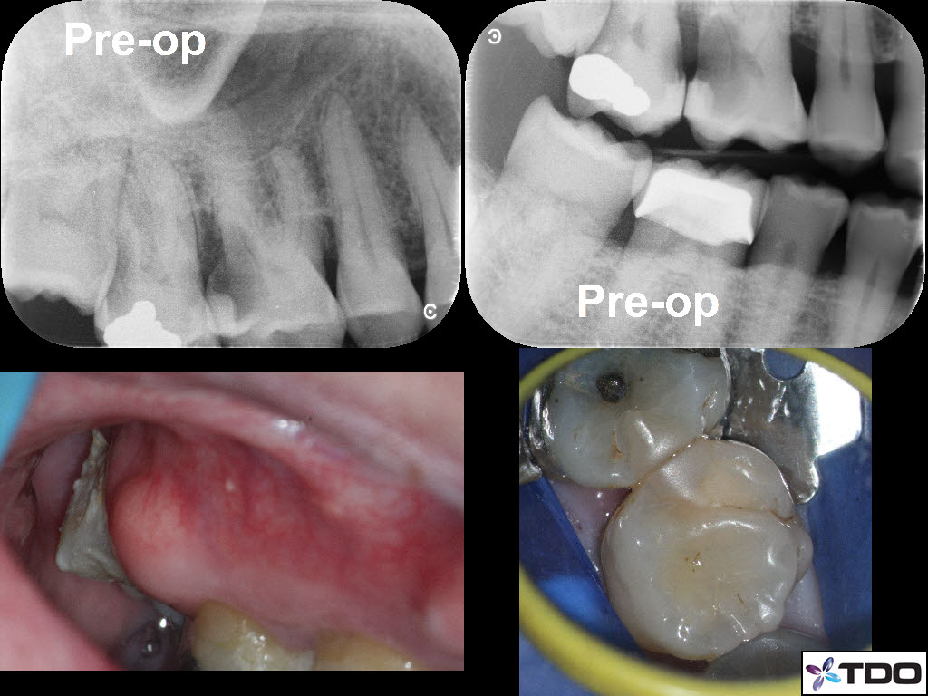 IAE #3 Opaldam Matrix 1