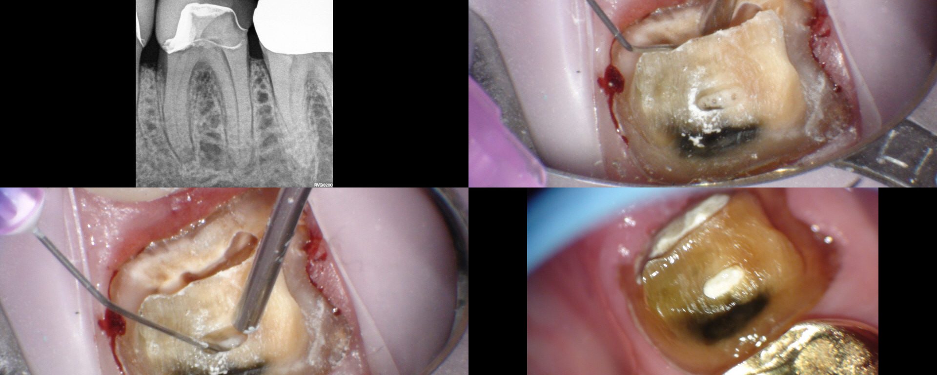 Access is planned, not prescribed