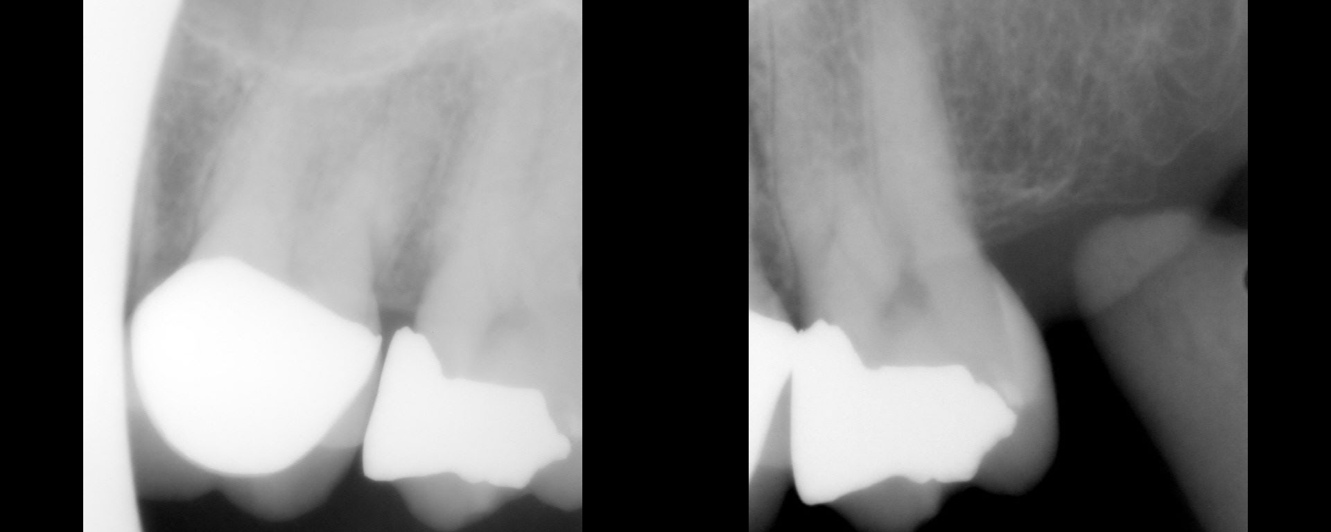 For those who think an EPT helps