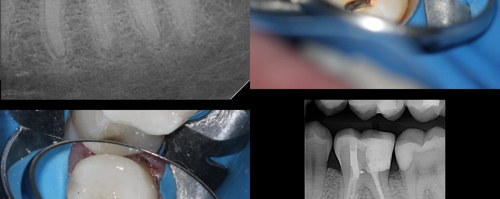 “Take ’em out”