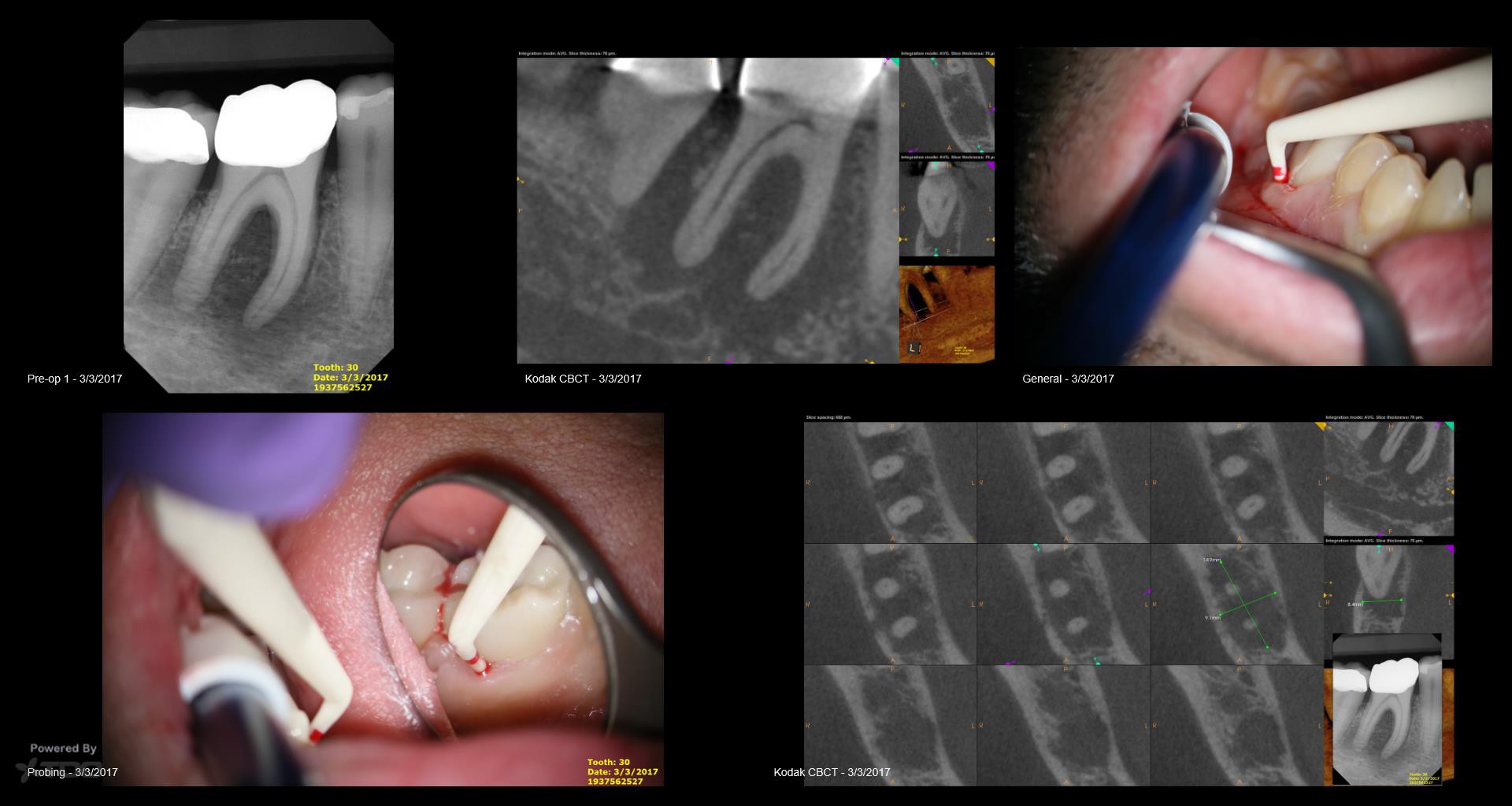 Collage-2140638584-Page00