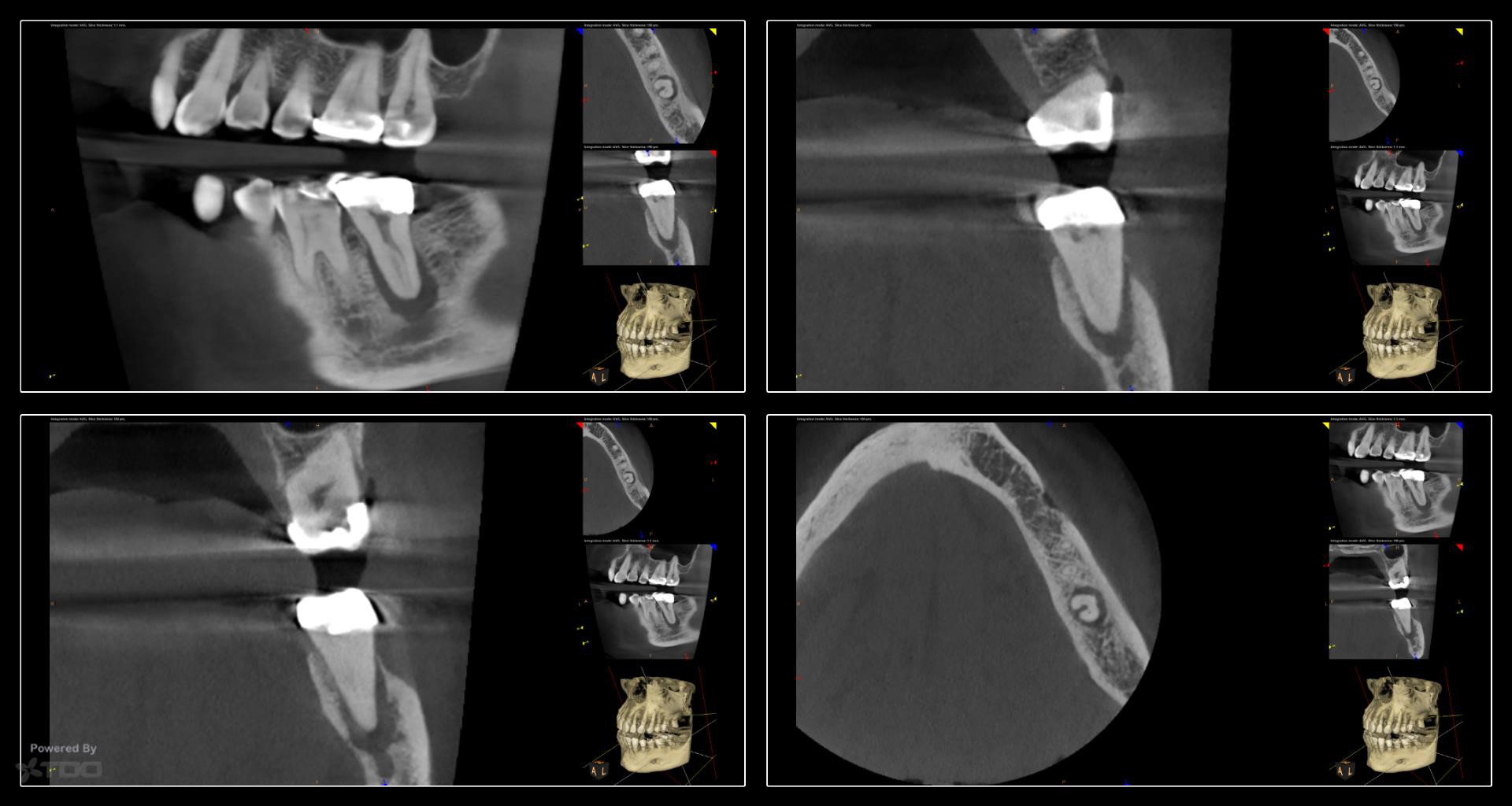 Collage-232332-Page00