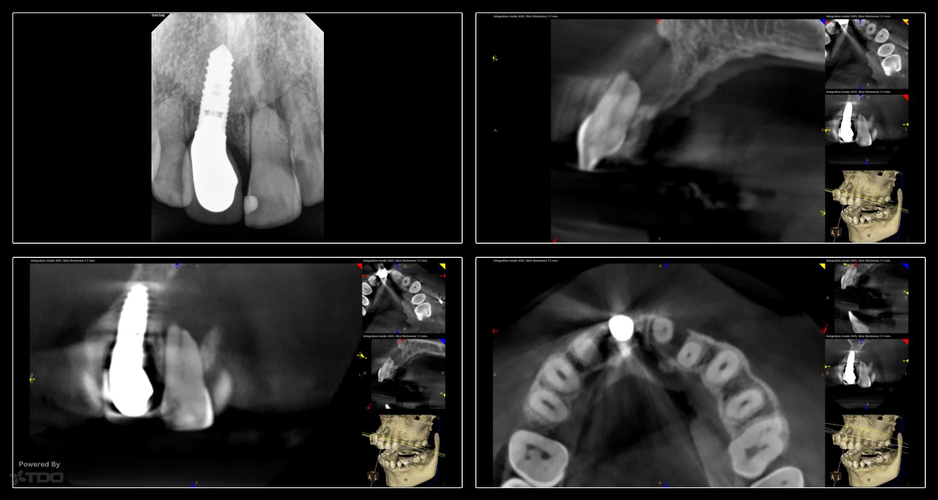 Collage-232629-Page00