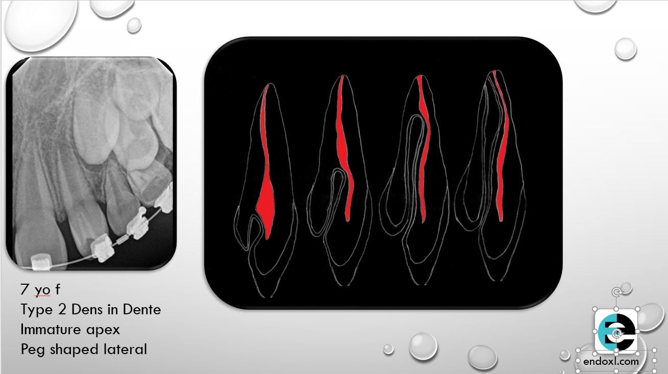 featured image regendo 10