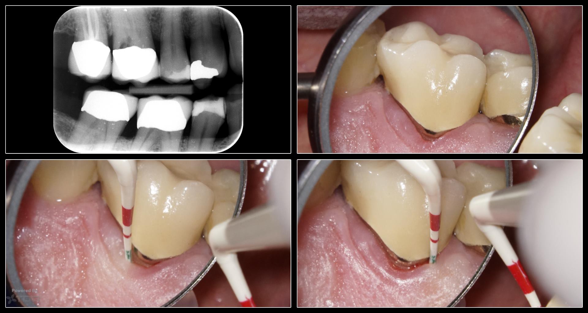 Collage-44140-Page00