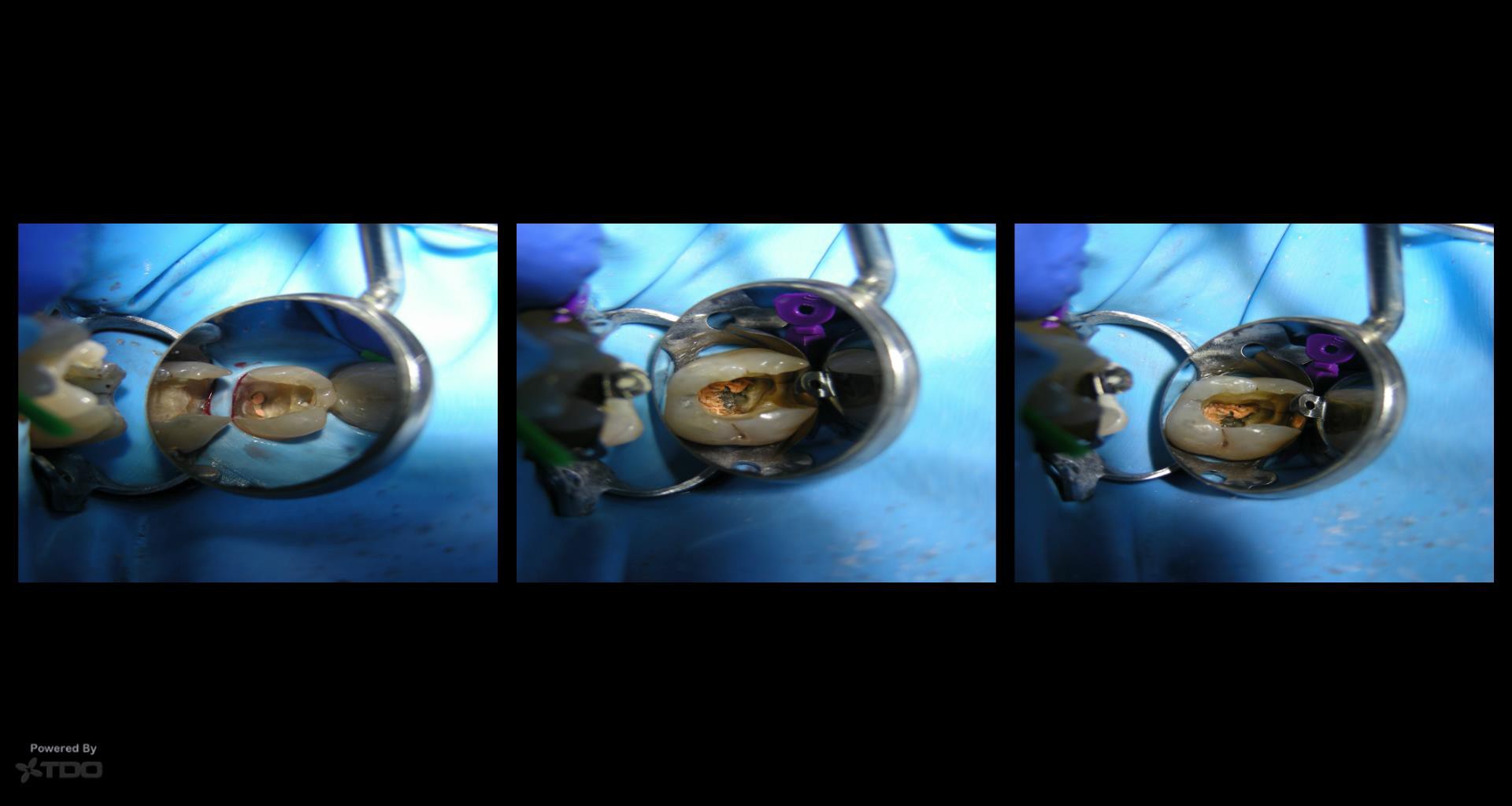 Collage-55735-Page00