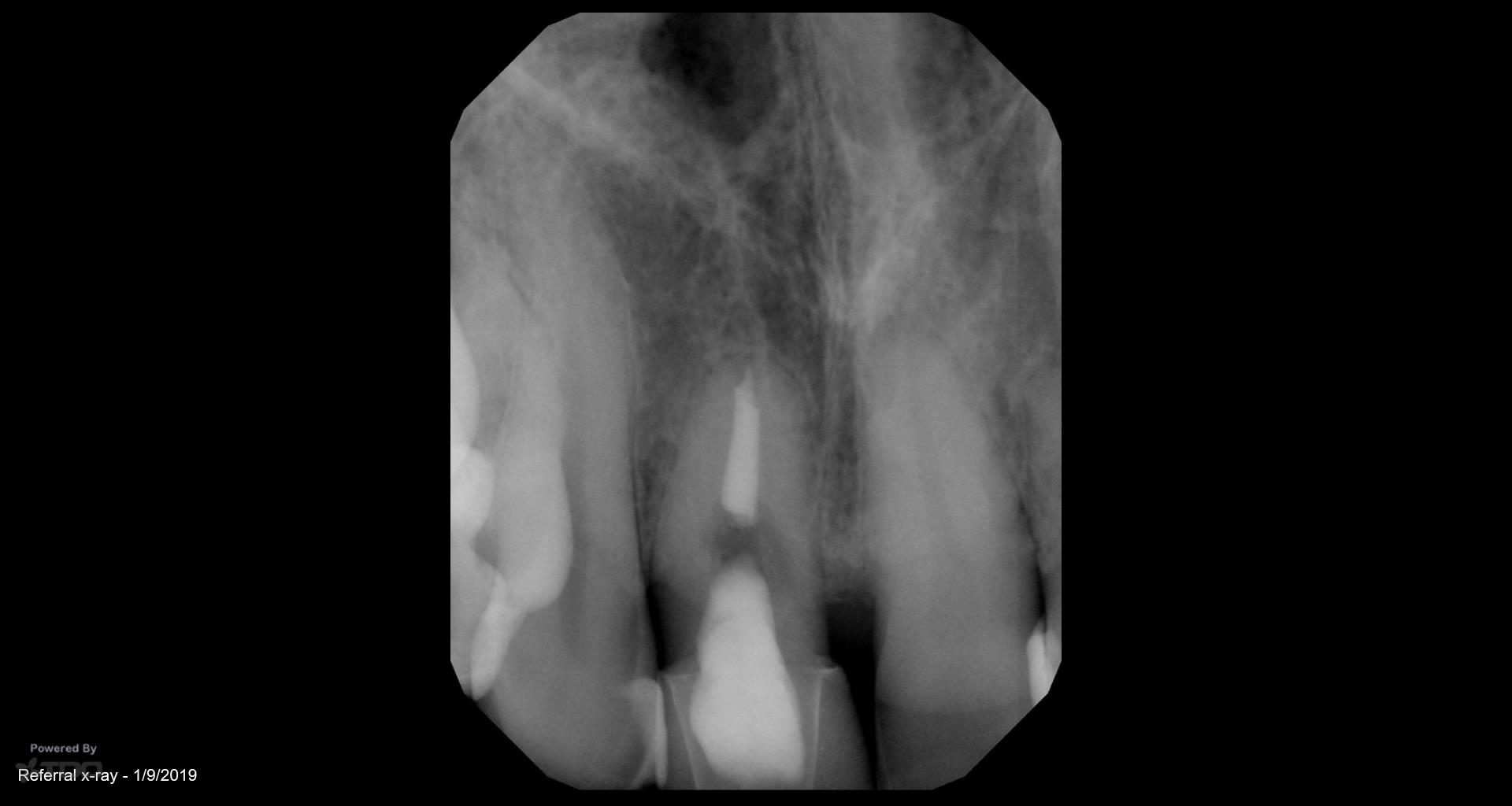 Collage-2140641984-Page00