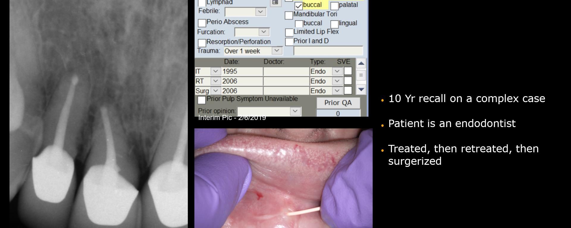 10 yr recall on treat/retreat/surgery case