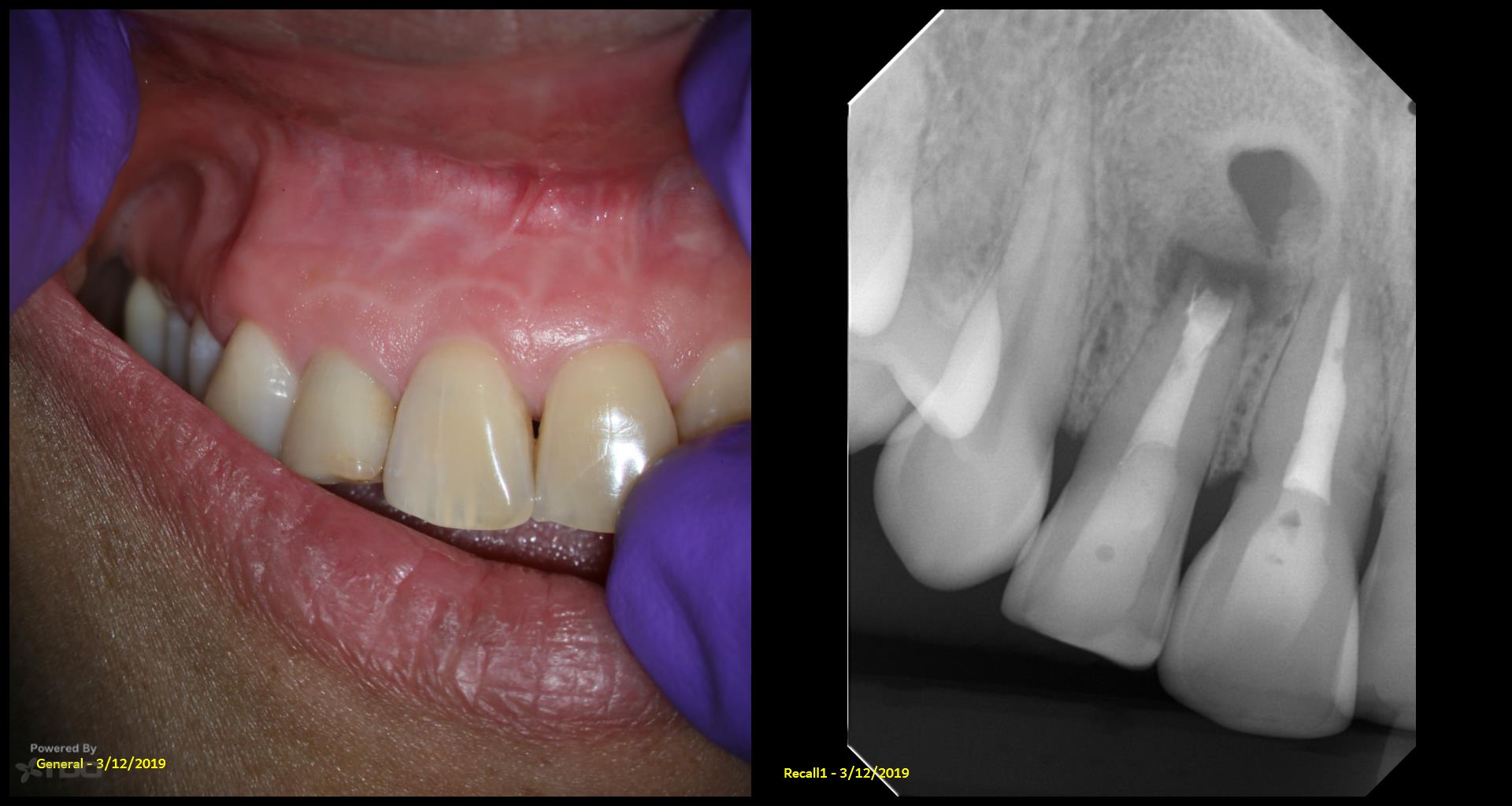 Collage-2140644756-Page00