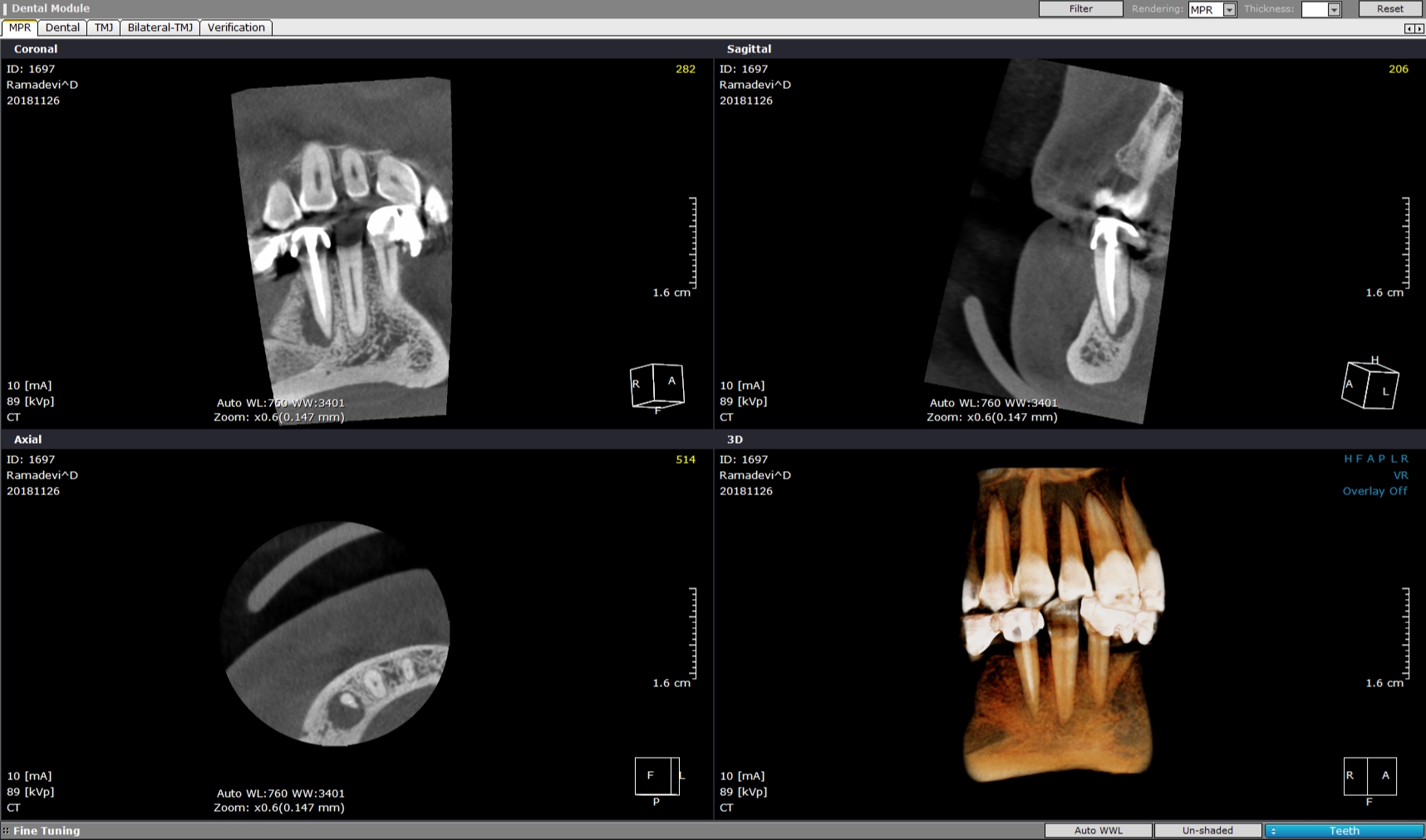 1697-cbct